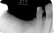 �p�O